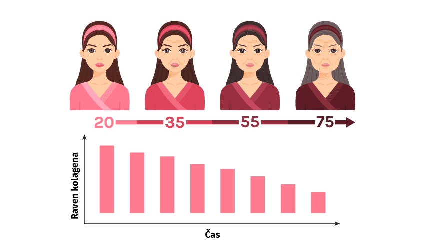 Slika možnosti izdelka