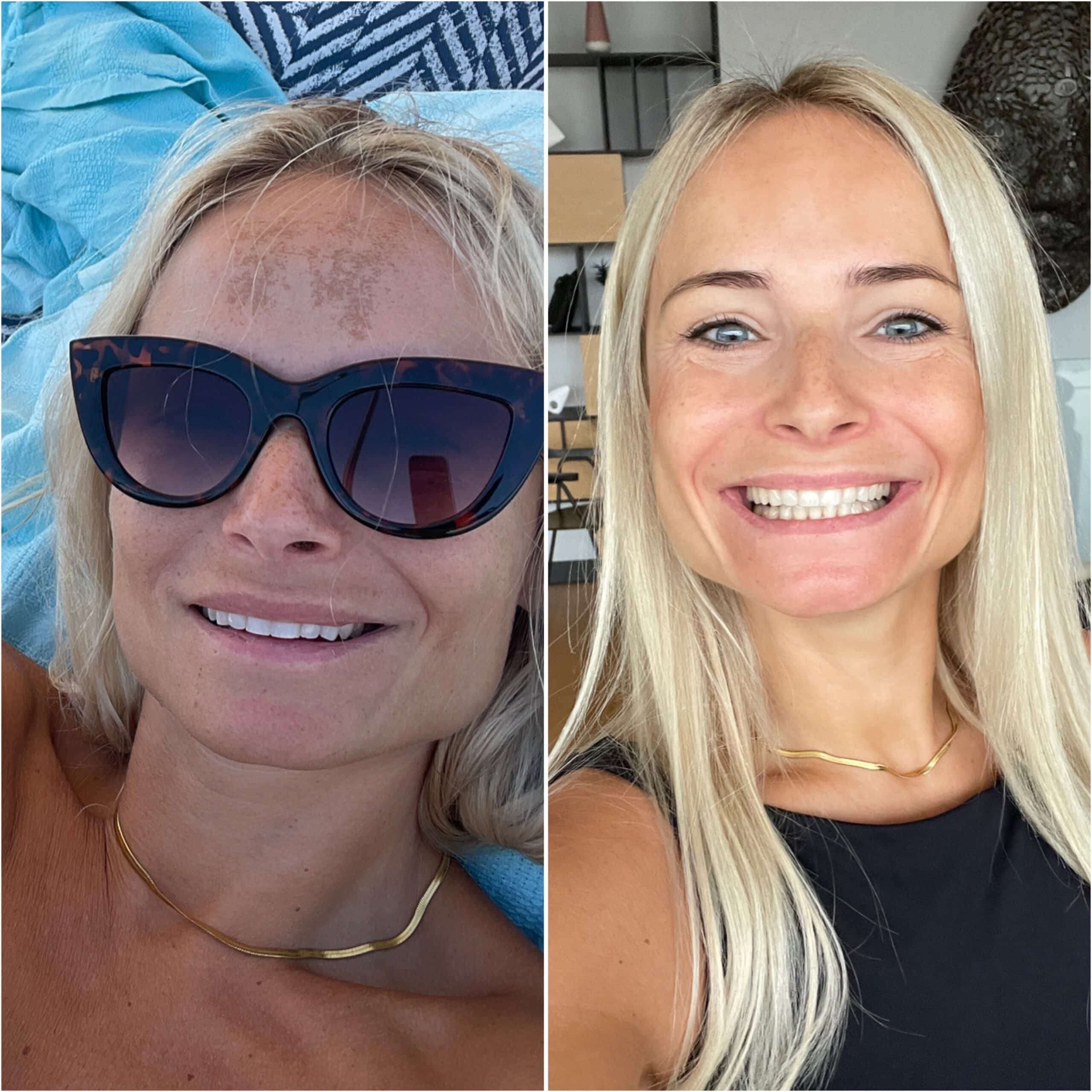 Slika možnosti izdelka