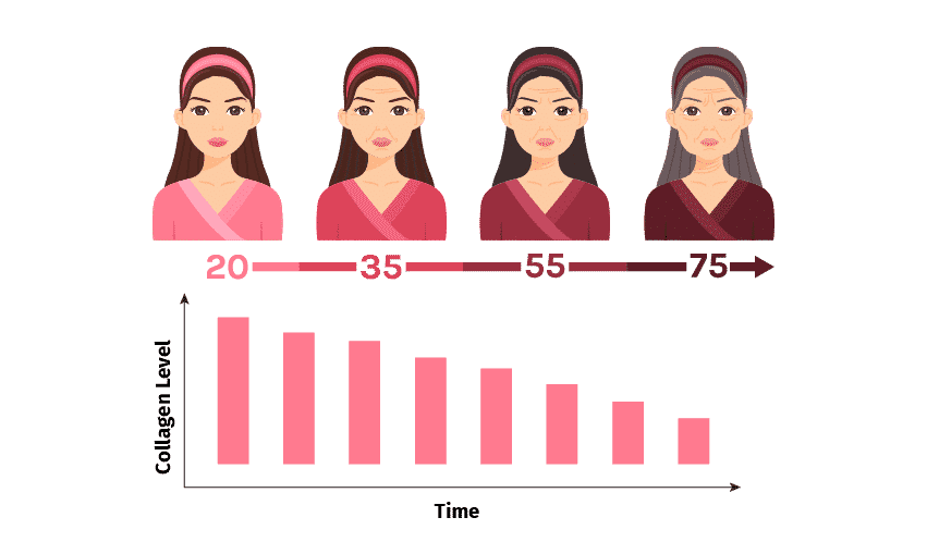 Slika možnosti izdelka